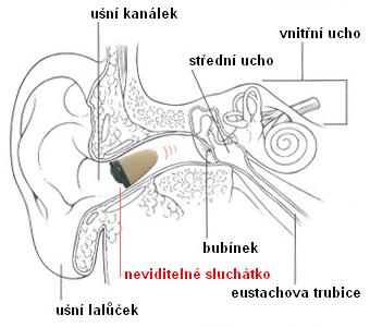 Neviditelné sluchátko v uchu